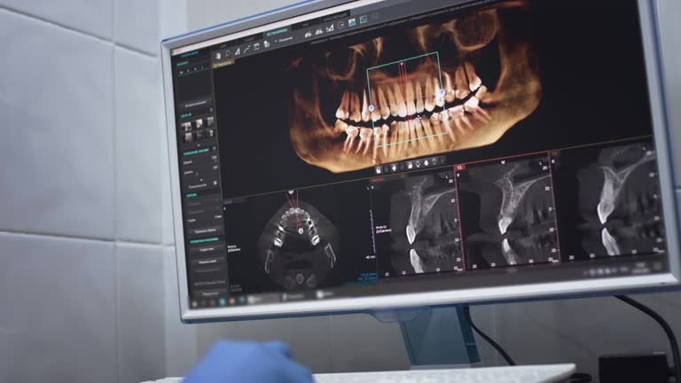 TMJ/TMD Treatment in Fort Pierre, SD